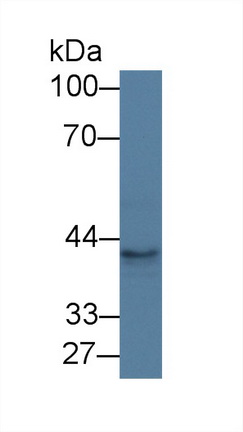 Polyclonal Antibody to Periphilin 1 (PPHLN1)