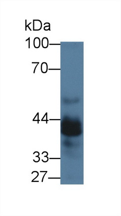 Polyclonal Antibody to Periphilin 1 (PPHLN1)