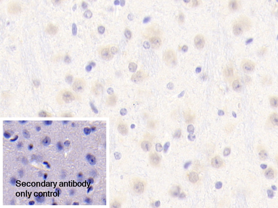 Polyclonal Antibody to Periphilin 1 (PPHLN1)