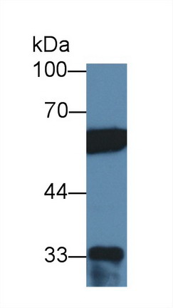 Polyclonal Antibody to Polypyrimidine Tract Binding Protein 1 (PTBP1)