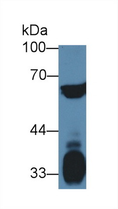 Polyclonal Antibody to Polypyrimidine Tract Binding Protein 1 (PTBP1)