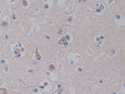 Polyclonal Antibody to Pancreas Specific Transcription Factor 1a (PTF1a)