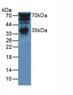 Polyclonal Antibody to Pancreas Specific Transcription Factor 1a (PTF1a)