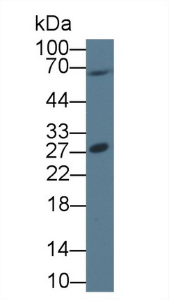 Polyclonal Antibody to Pituitary Tumor Transforming 1 (PTTG1)