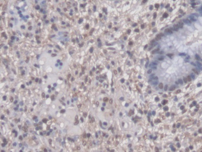 Polyclonal Antibody to Pituitary Tumor Transforming 1 (PTTG1)