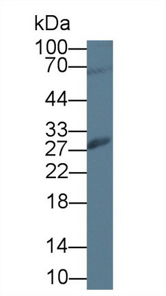 Polyclonal Antibody to Pituitary Tumor Transforming 1 (PTTG1)