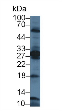 Polyclonal Antibody to Pituitary Tumor Transforming 1 (PTTG1)