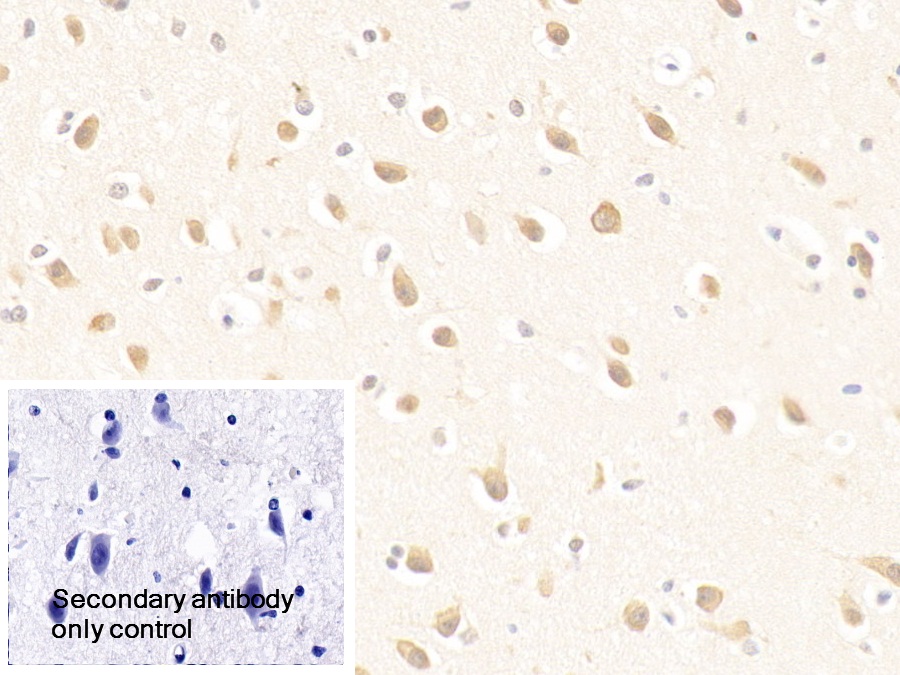 Polyclonal Antibody to Purine Rich Element Binding Protein A (PURA)