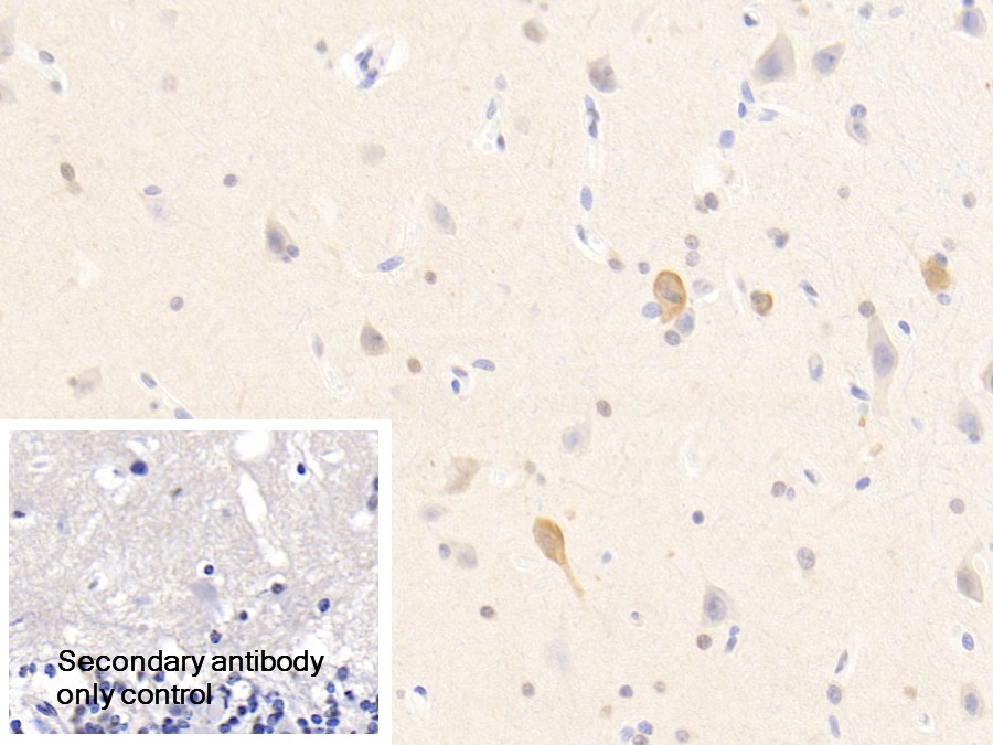 Polyclonal Antibody to Purine Rich Element Binding Protein A (PURA)