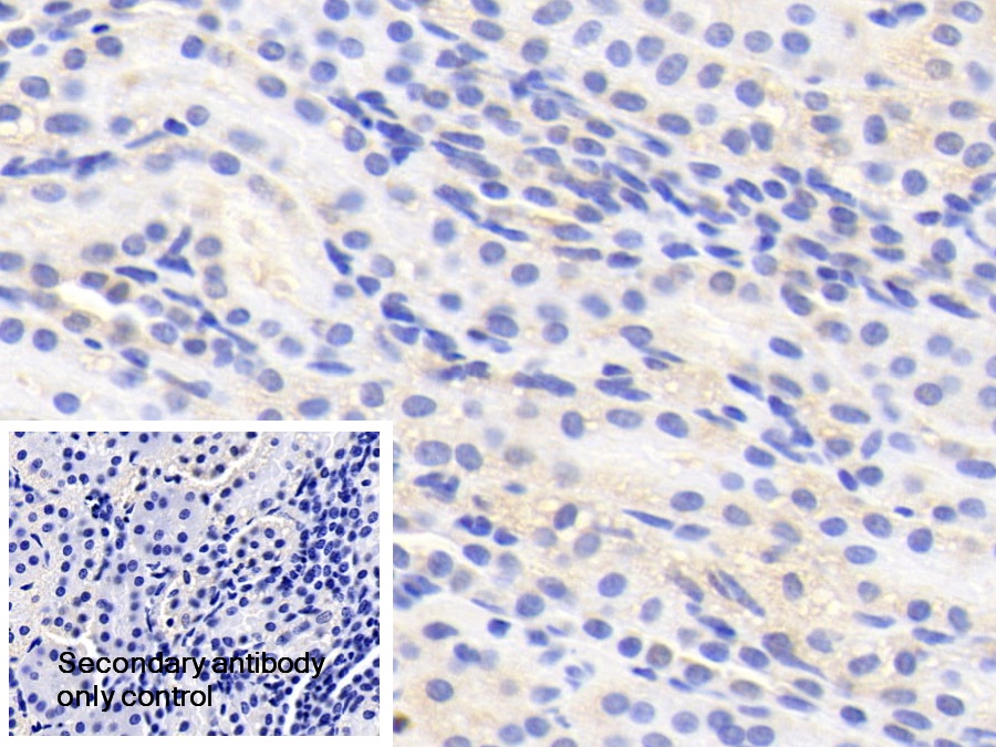 Polyclonal Antibody to Purine Rich Element Binding Protein A (PURA)