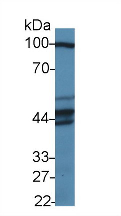 Polyclonal Antibody to Pseudouridylate Synthase 1 (PUS1)