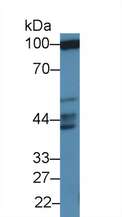 Polyclonal Antibody to Pseudouridylate Synthase 1 (PUS1)