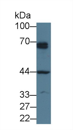 Polyclonal Antibody to Parathyroid Hormone Receptor 1 (PTHR1)