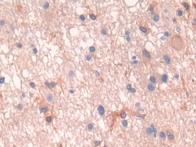 Polyclonal Antibody to Parathyroid Hormone Receptor 1 (PTHR1)