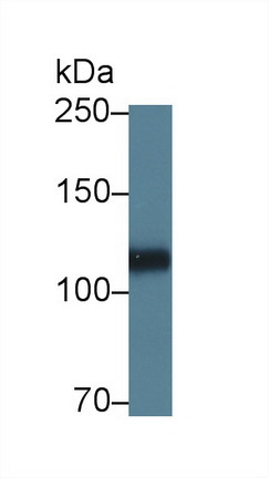 Polyclonal Antibody to Heparan Sulfate Proteoglycan 2 (HSPG2)