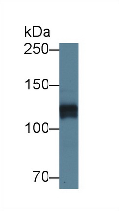 Polyclonal Antibody to Heparan Sulfate Proteoglycan 2 (HSPG2)