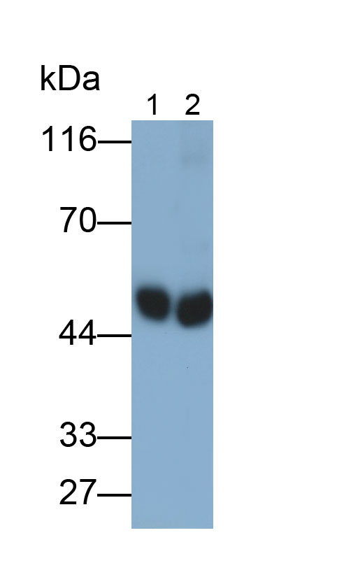 Polyclonal Antibody to Phenylalanine Hydroxylase (PAH)