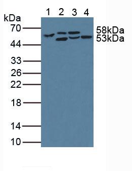 Polyclonal Antibody to Phenylalanine Hydroxylase (PAH)