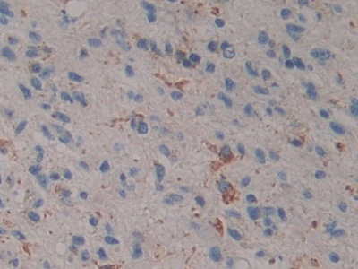 Polyclonal Antibody to Prosaposin (PSAP)