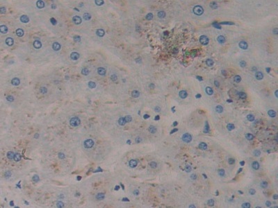 Polyclonal Antibody to Prosaposin (PSAP)