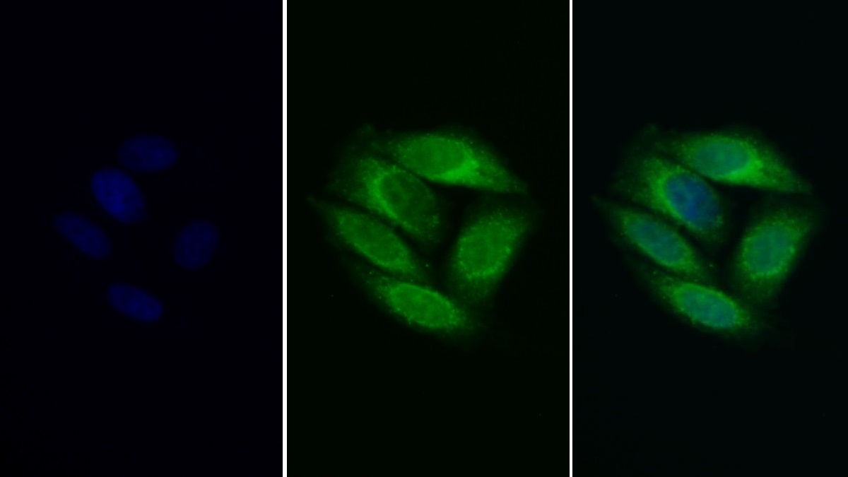 Polyclonal Antibody to Prosaposin (PSAP)