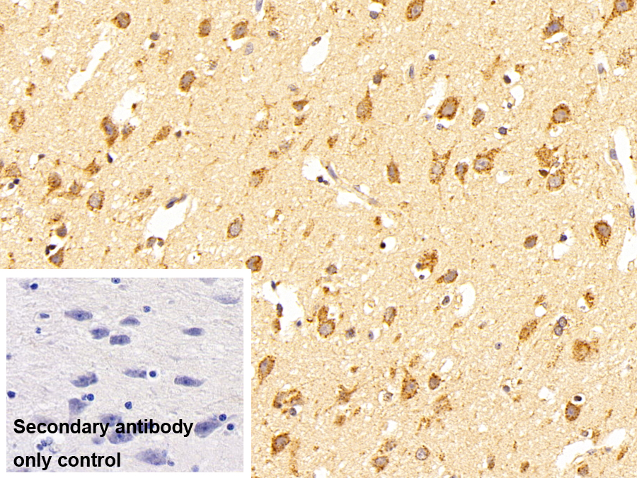 Polyclonal Antibody to Prosaposin (PSAP)