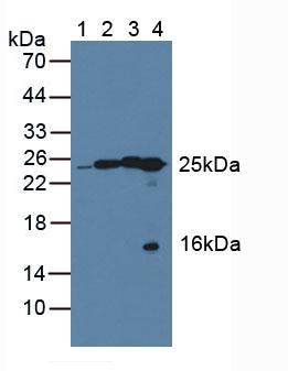 Polyclonal Antibody to Quinoid Dihydropteridine Reductase (QDPR)