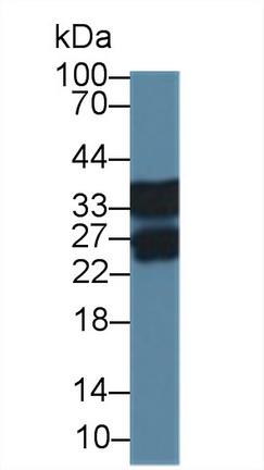 Polyclonal Antibody to Regucalcin (RGN)