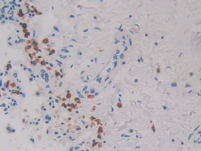 Polyclonal Antibody to Ribophorin I (RPN1)