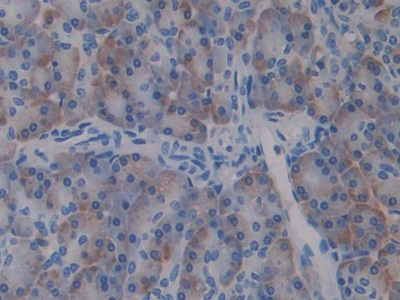 Polyclonal Antibody to Ribophorin I (RPN1)