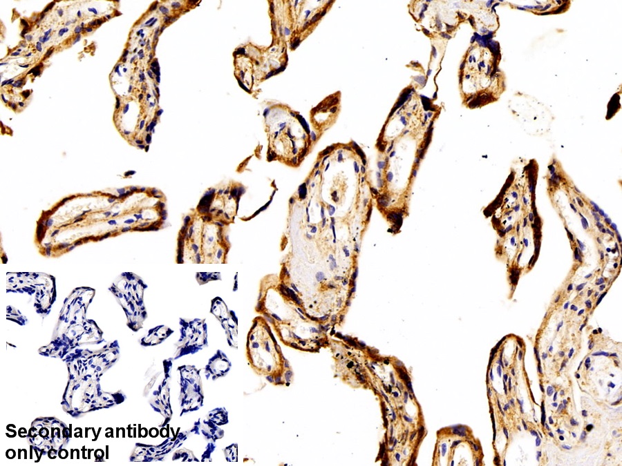 Polyclonal Antibody to Ribophorin I (RPN1)