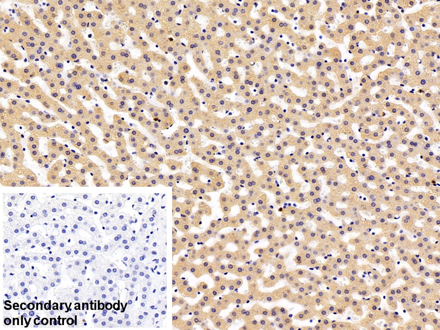 Polyclonal Antibody to Ribophorin I (RPN1)