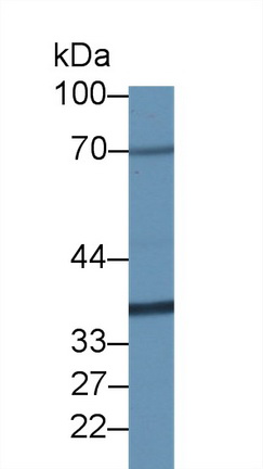 Polyclonal Antibody to Ribophorin I (RPN1)