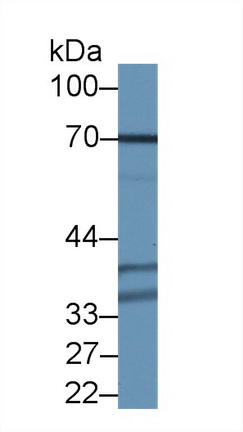 Polyclonal Antibody to Ribophorin I (RPN1)