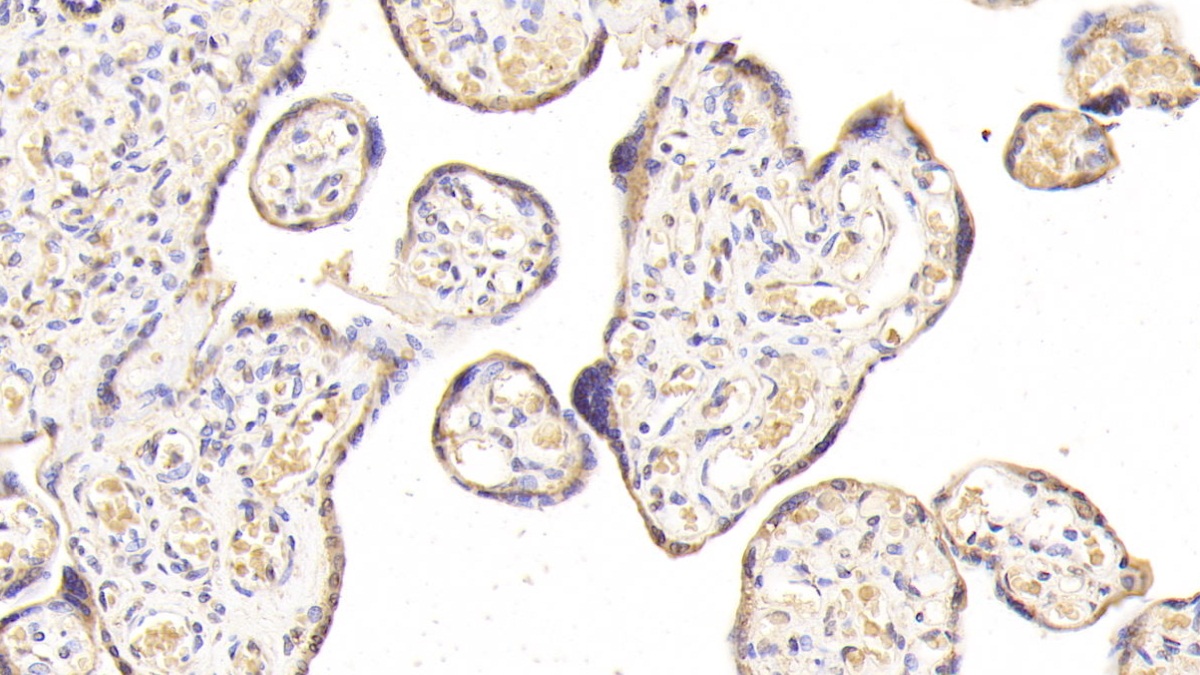 Polyclonal Antibody to Ribophorin I (RPN1)