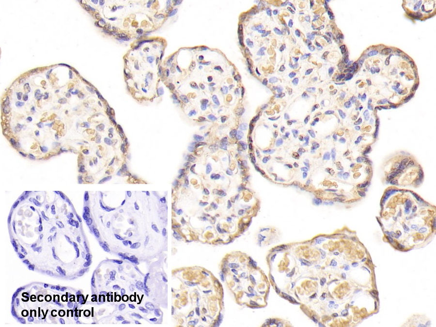 Polyclonal Antibody to Ribophorin I (RPN1)