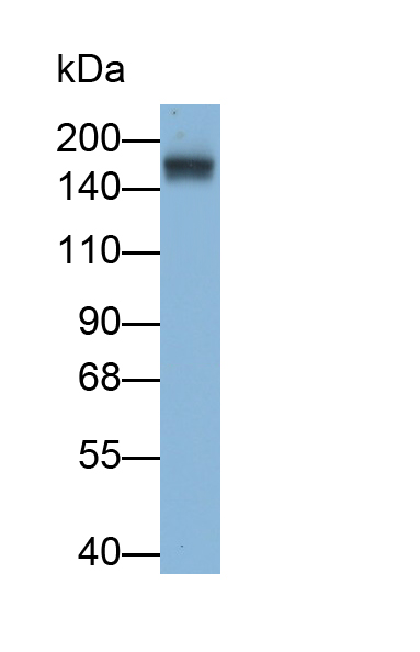 Polyclonal Antibody to Ribosome Binding Protein 1 (RRBP1)