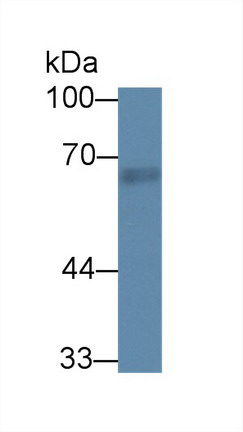 Polyclonal Antibody to Rhotekin (RTKN)