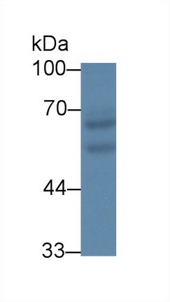 Polyclonal Antibody to Rhotekin (RTKN)