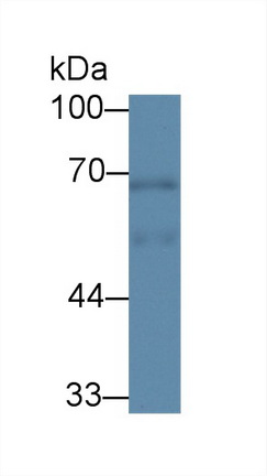 Polyclonal Antibody to Rhotekin (RTKN)