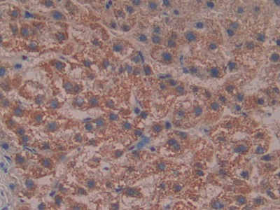 Polyclonal Antibody to Reelin (RELN)