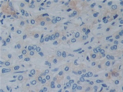 Polyclonal Antibody to Reelin (RELN)