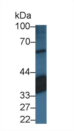 Polyclonal Antibody to Retinaldehyde Binding Protein 1 (RLBP1)