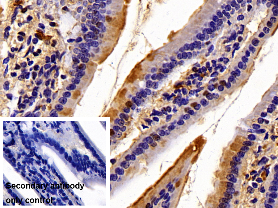 Polyclonal Antibody to Tubulin Folding Cofactor A (TBCA)