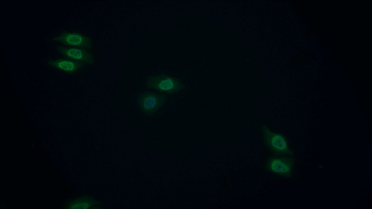 Polyclonal Antibody to Tyrosyl DNA Phosphodiesterase 1 (TDP1)