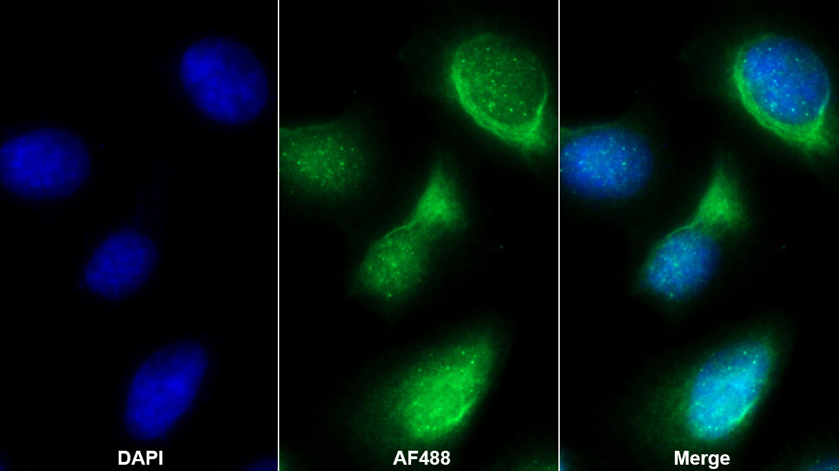 Polyclonal Antibody to Telomeric Repeat Binding Factor 1 (TERF1)