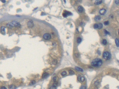 Polyclonal Antibody to Transmembrane Protein 1 (TMEM1)