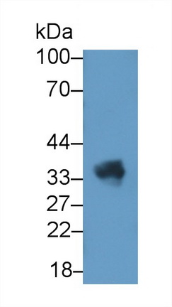 Polyclonal Antibody to Transmembrane Protein 1 (TMEM1)