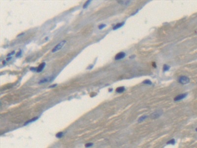 Polyclonal Antibody to Transmembrane Protein 1 (TMEM1)