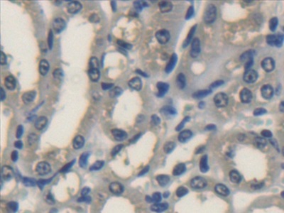 Polyclonal Antibody to Transmembrane Protein 1 (TMEM1)